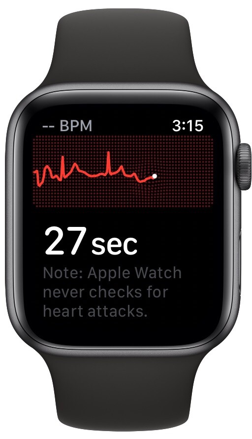 如何在 Apple Watch 上记录心电图