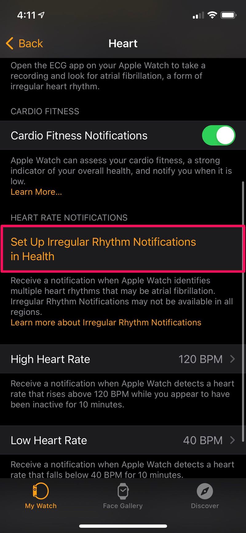 如何设置 Apple Watch 通知高心率